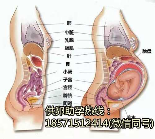 2021天津找人代生孩子价钱,做试管婴儿女性睾酮素低影响排卵吗