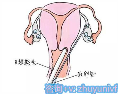 试管助孕周期中促排卵的科学解析